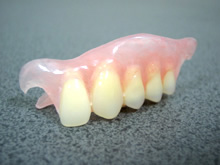 新素材を使用した弾性義歯をノンクラスプデンチャー（保険適応外）